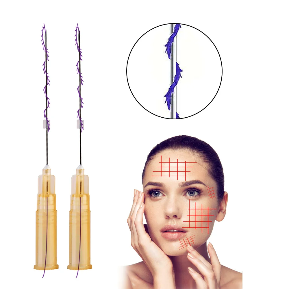 

20Pcs/Bag Mini Cog Screw 25g Hilos Tensores Faciales Ultra V Lift Barbed 38/60mm Pdo Thread For Face Tightening Skin Care