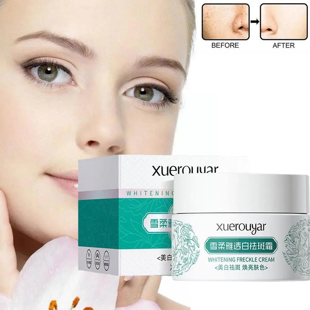 

White Spot Cream Herbal Whitening Freckle Removal Cream Repair Care Face Products Cream Spot Fade Fading Skin Cream Spots R3W9