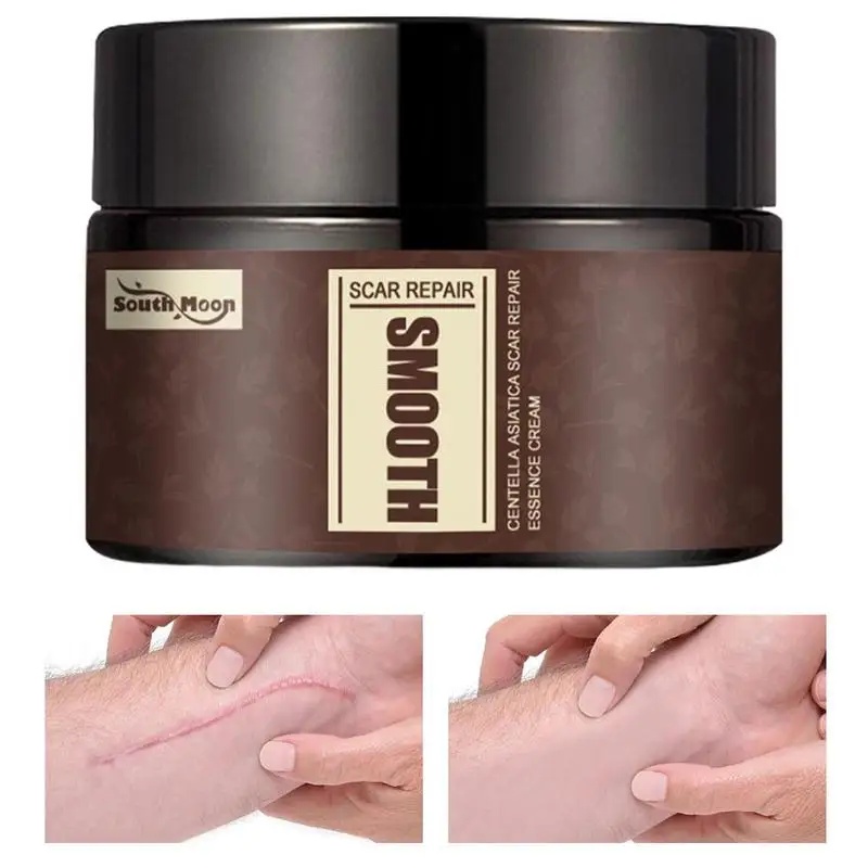 

Scar Removal Cream For Women And Men Plumping Face Serums Hydrating Facial Skin Care Product Essential Skincare Skin Care Niacin