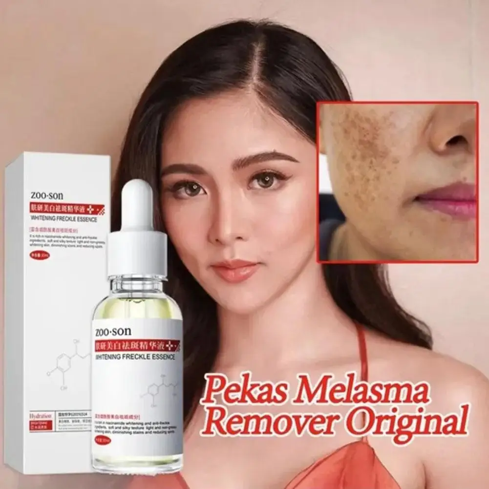 

30ml Dark Spot Remover For Face Original Effective Freckle Whitening Essence Oil Hydrating Deep Moisturizing Beauy Makeup T Y0L2