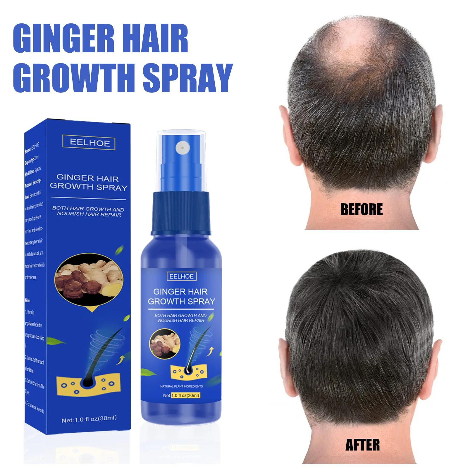 

EELHOE Ginger Hair Growth Spray Scalp Massage Moisturizing Thick Hair Loss Nutrient Essence Serum Hairline Beard Growth Oil