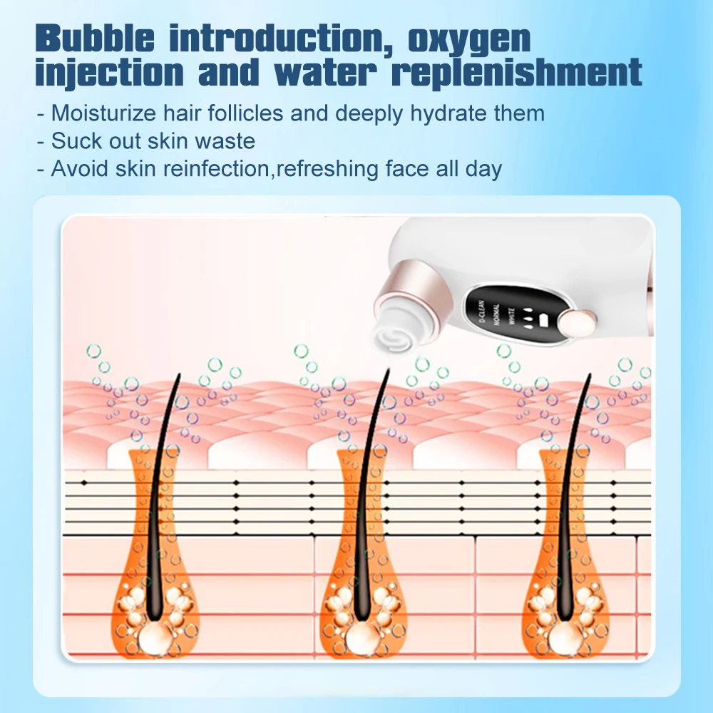 Аппарат вакуумный для удаления черных точек акне и прыщей