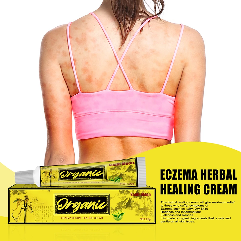 

Chinese Herbal Advanced Body Psoriasis Cream For Dermatitis and Eczema Pruritus Psoriasis Ointment Herbal Creams 20g