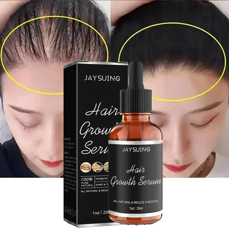 Hair Growth Serum Products Anti Hair Loss Fast Growth Prevent Baldness Treatment Scalp Dry Damaged Essence Beauty Hair Care 29ml