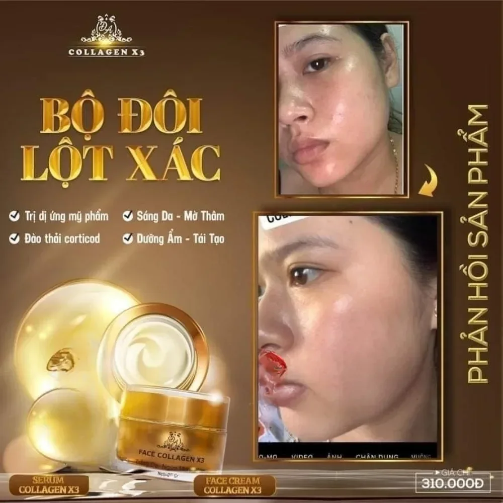 Крем для лица Kem Duong Da Colagen X3 отбеливающий уход за кожей крем женщин