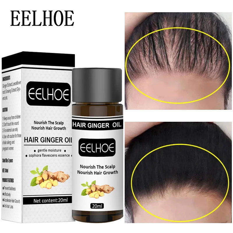 Имбирная Бриллиантовая сыворотка бриллиантовый уход Восстанавливающее