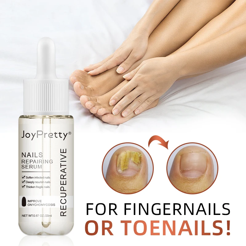 

AUQUEST Fungal Nail Treatment Serum Foot Repair Essence Care Whitening Toe Nail Fungus Removal Gel Anti Infection 20ml