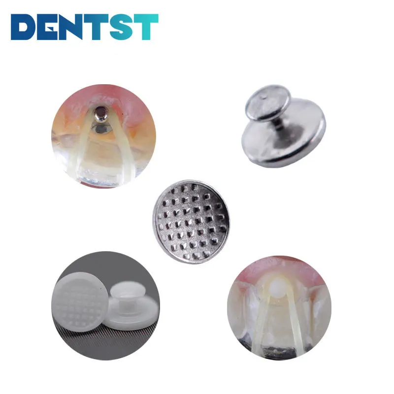 

Стоматологическая ортодонтика Dentst 50 шт./кор., металлические прозрачные керамические композитные кнопки, языки для ортодонтии