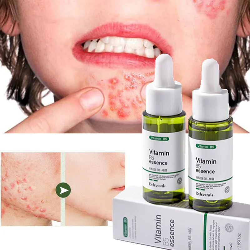 

Увлажняющая отбеливающая Сыворотка для лица с гиалуроновой кислотой, 30 мл