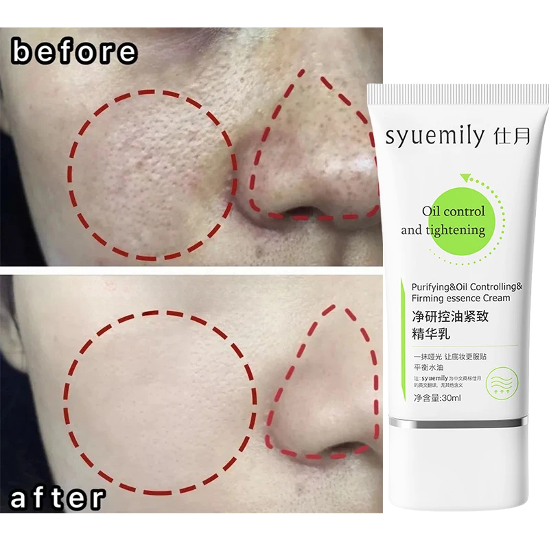 Крем для сужения пор с салициловой кислотой быстрое устранение больших удаление