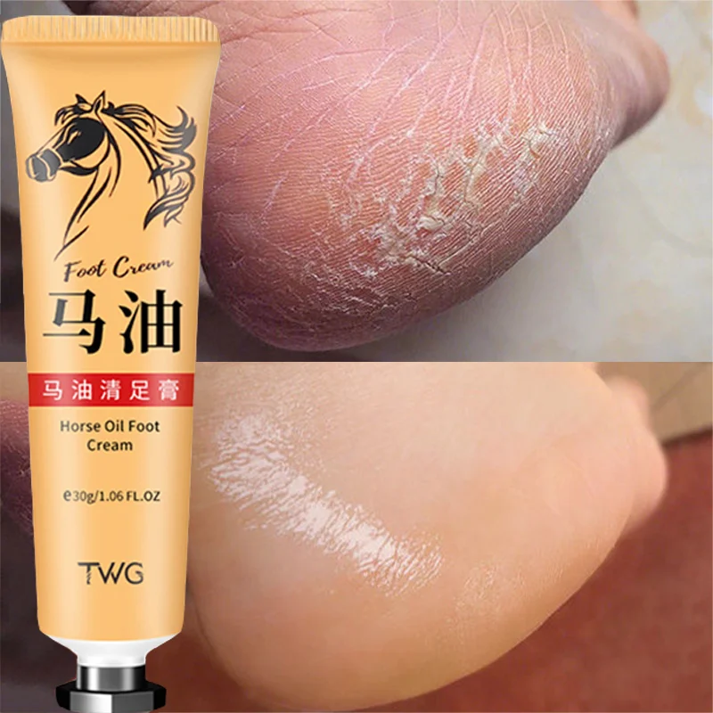 

Anti Crack Foot Cream Heel Cracked Repair Horse Oil Cream Smooth Removal Dead Skin Callus Anti-Drying Hand Feet Skin Care 30g