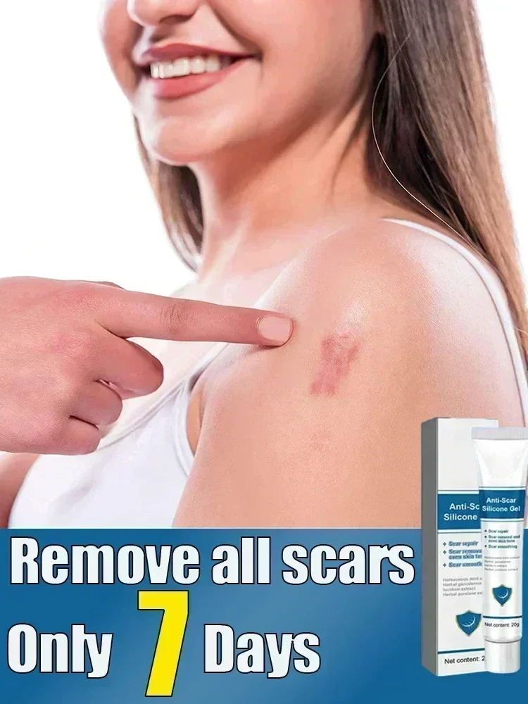 ГОРЯЧАЯ ПРОДАЖА гель для быстрого удаления шрамов мазь от лечения Keloid растяжки