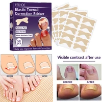 1 box of elastic toenail correction stick nail groove positive nail buckle corrector pull stick nail repair