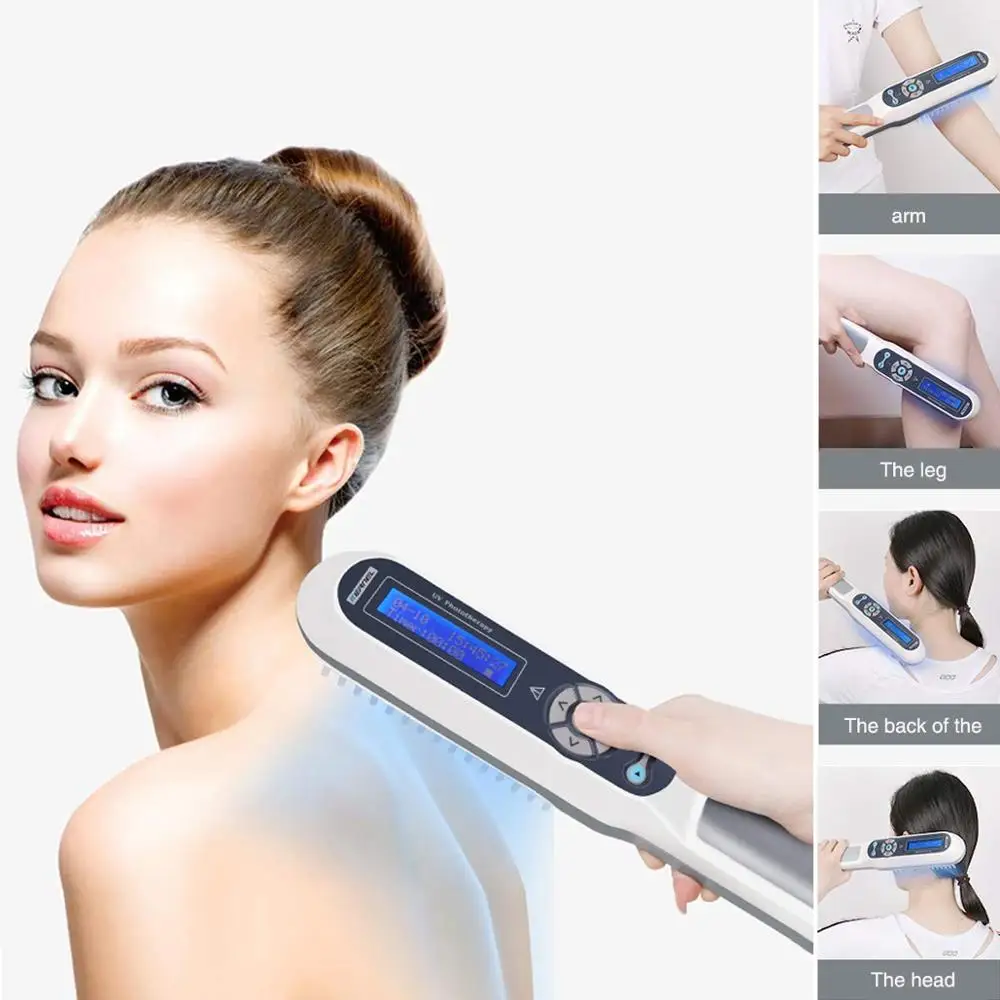 

ISO 13485 handheld medical device/uvb lamp phototherapy psoriasis/ vitiligo treatment 311nm