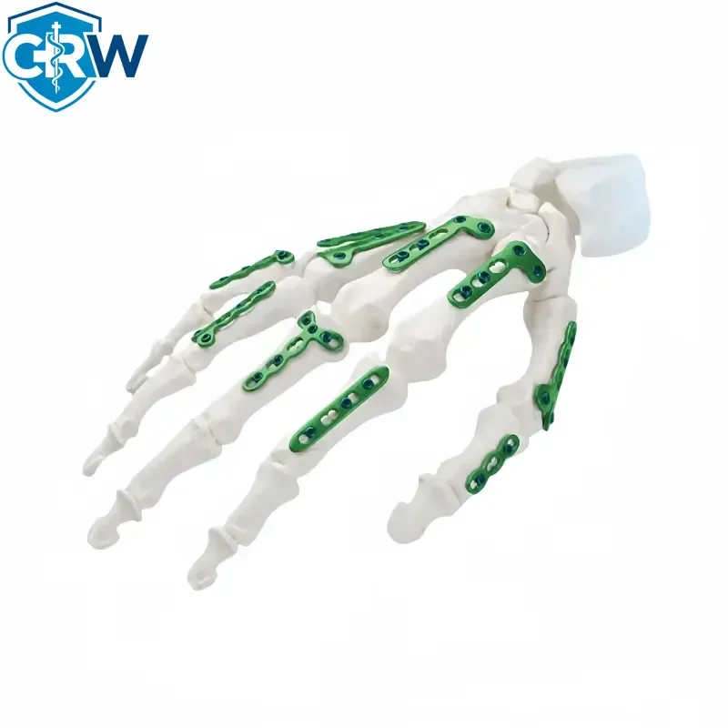 Фото Реконструкционная блокирующая пластина CRW 2.0S Mini T DAFINKI MEDICAL, сертифицированная CE ISO, класс III, гарантия 3 года, OEM/ODM №4