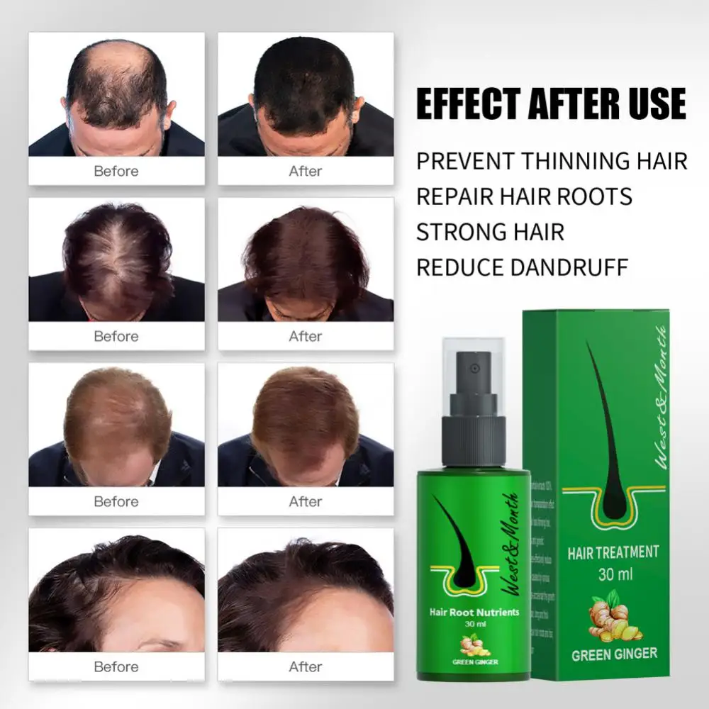 1/3/5 шт. спрей для роста волос