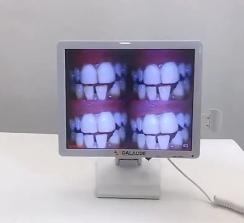 

Wi-Fi-передача стоматологических интраоральных цифровых USB-фотоаппаратов 1/4/16 фотографий