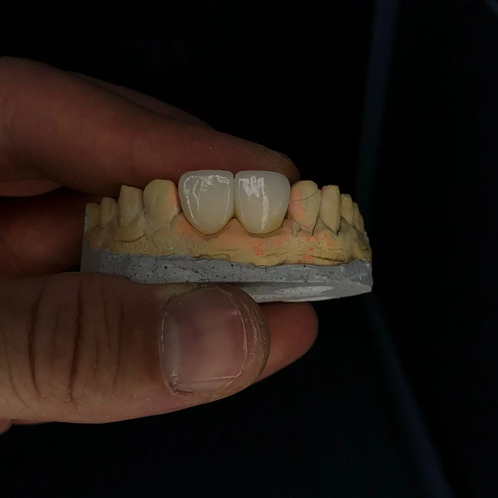 thumb