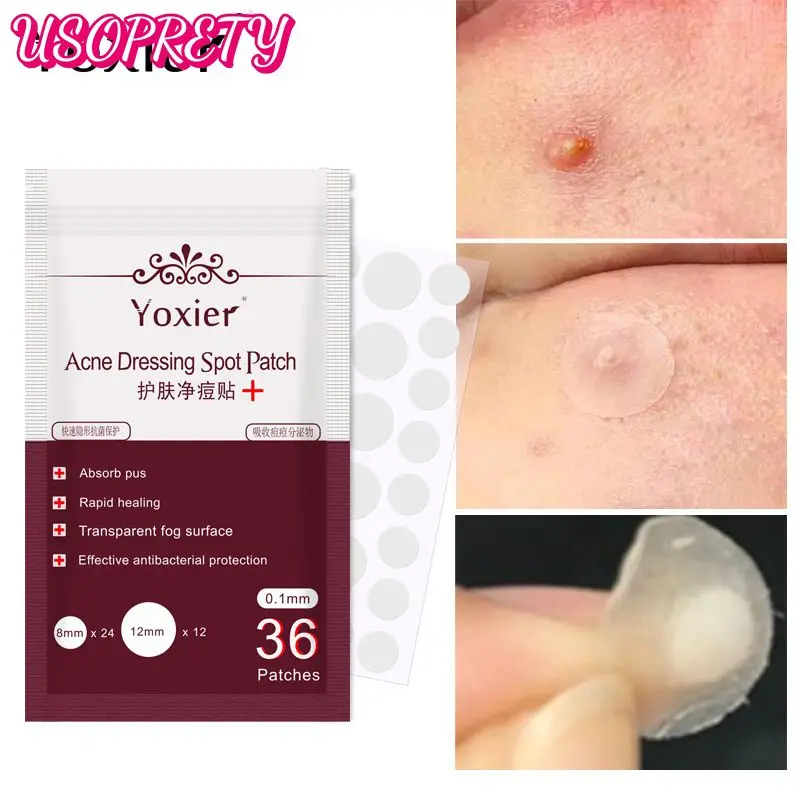 

36pcs Pimple Master Patch Acne Patch Skin Tags Protects Wounded Or Troubled Areas Beauty Set Makeup Tools Painless Hot