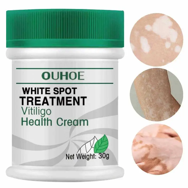 

30g Effective Herbal Extract Repair Cream Ointment Remove White Spot Removal Skin White Spot Fade Sweat Spots Cream