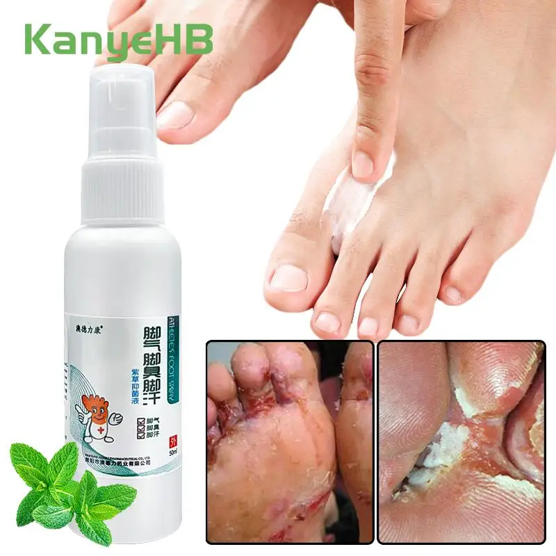 1 шт., спрей для лечения грибка и снятия зуда на ногах