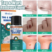 wart tag remover liquid painless anti infection mole skin dark spot freckle warts treatment serum face tag removal essential oil