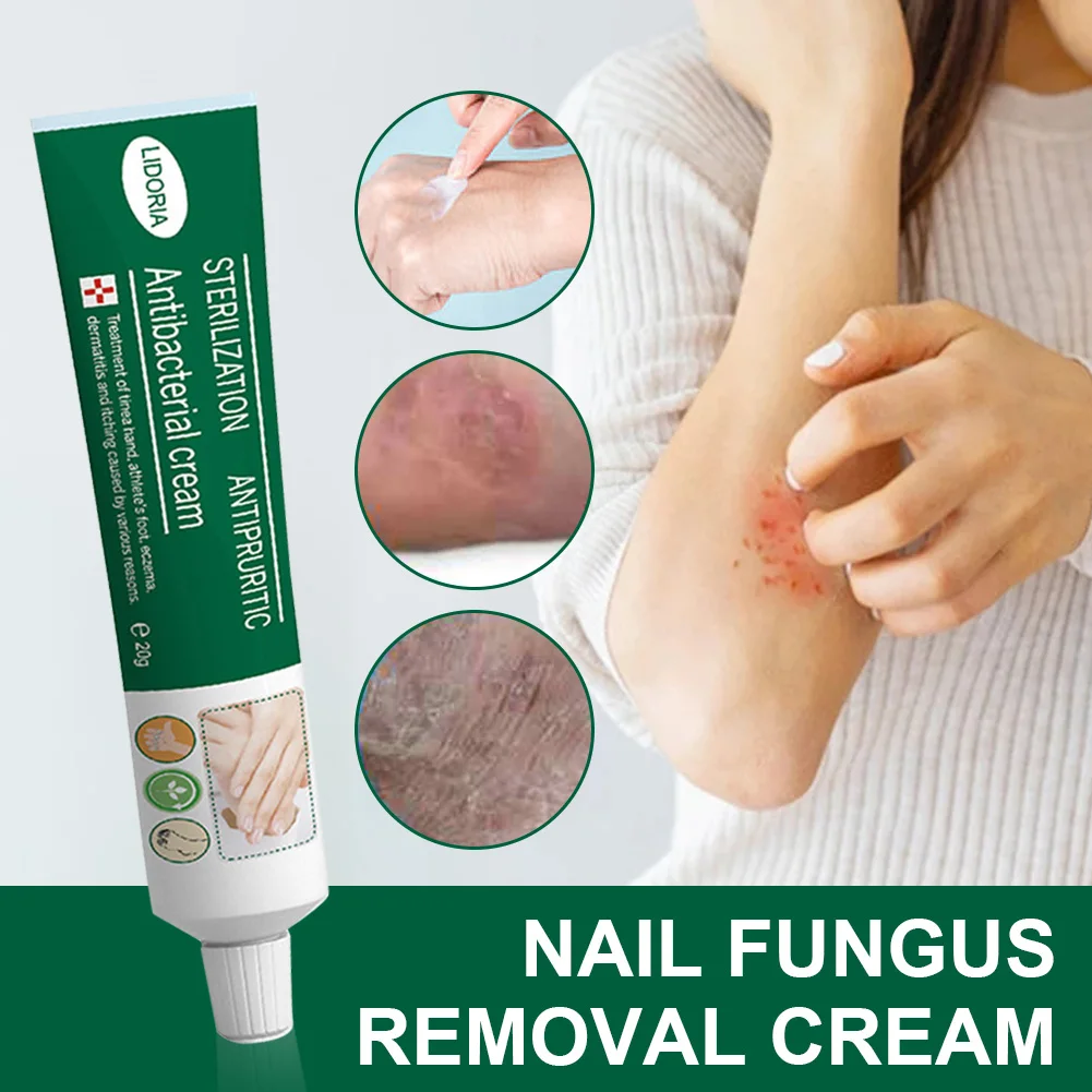 

Herbal Foot Treatment Nail Fungus Removal Cream Natural Ointment Cracked Peeling Onychomycosis Paronychia Repair
