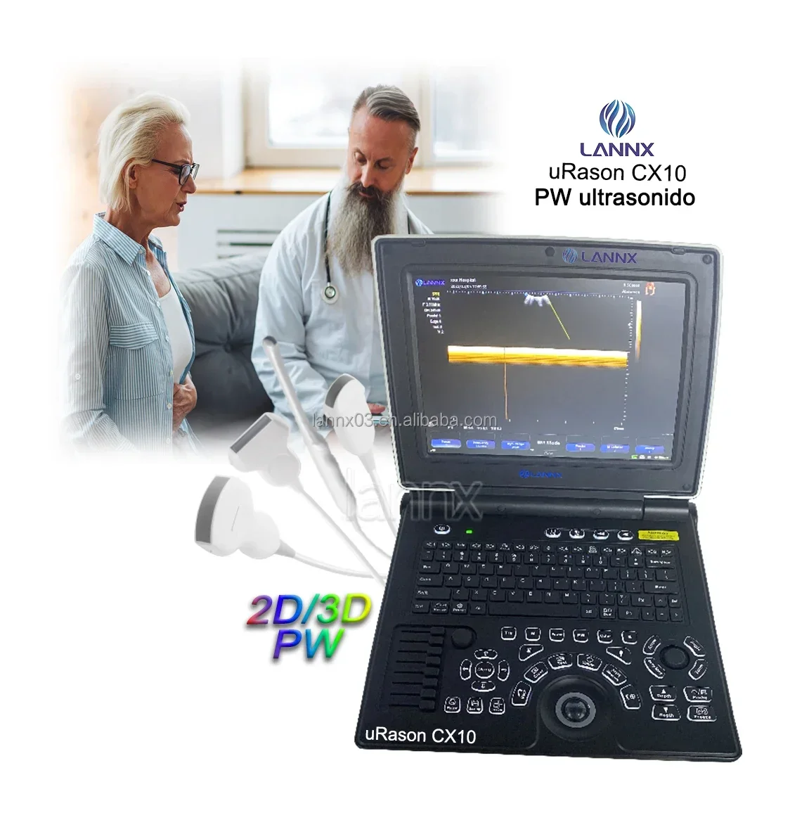 LANNX uRason CX10 Ecografo цифровой кардиологический ультразвуковой аппарат цветной