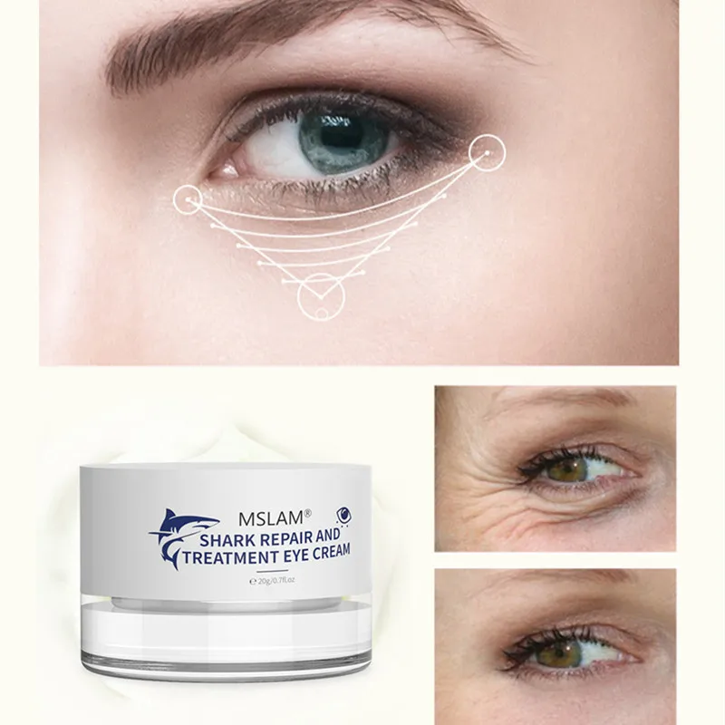 

Mango Eye Cream Anti-Wrinkle Moisturizing Anti-Age Remove Dark Circles Eye Care Against Puffiness And Bags Hydrate Cream 4.9