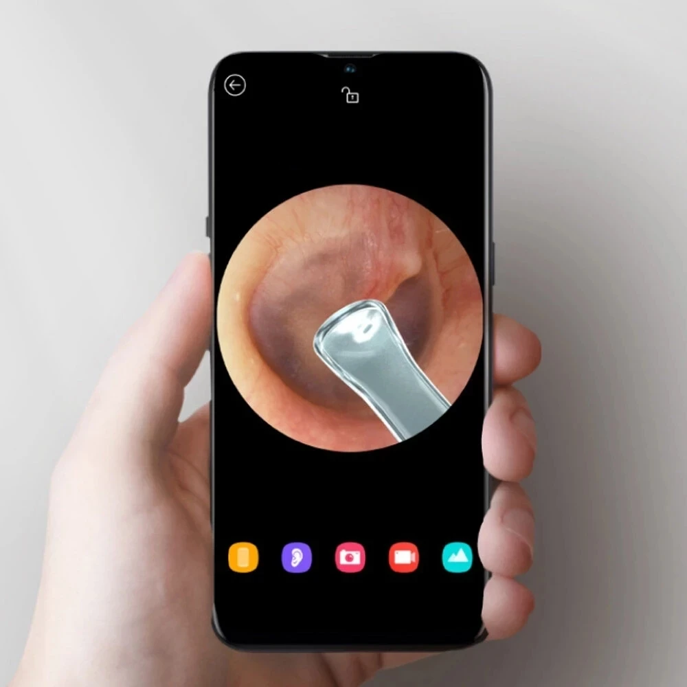 Умный визуальный ушной эндоскоп Xiaomi Mijia Bebird R1 300 Вт высокоточный вкладыш отоскоп