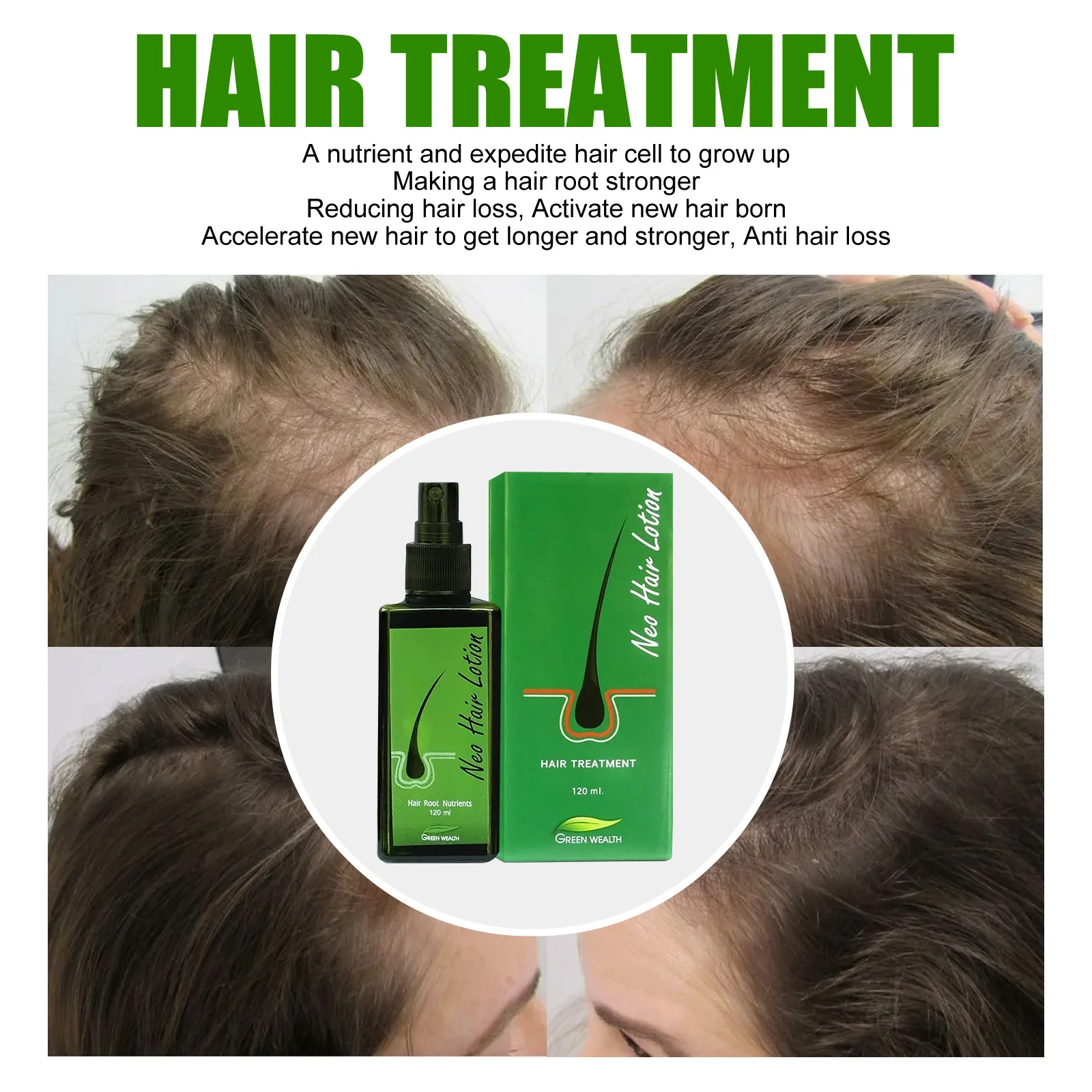 Three Scouts Hair Growth Spray Prevent Hair Loss Scalp Treatments Thicken Hair Shampoo Set Beauty Health Hair Care