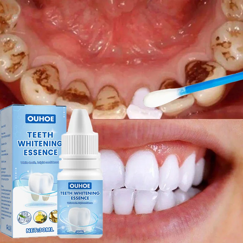 Teeth Whitening Essence Remove Plaque Stains Yellow Teeth Gel Oral Hygiene Cleansing Bleaching Products Fresh Breath Dental Tool