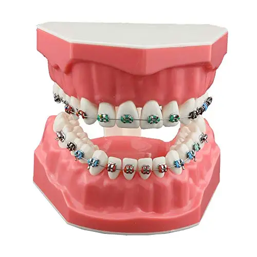 Dental Typodonts Orthodontics Demonstration Model with Metal Wires and Bracket Teaching, Learning, Interpretation Model