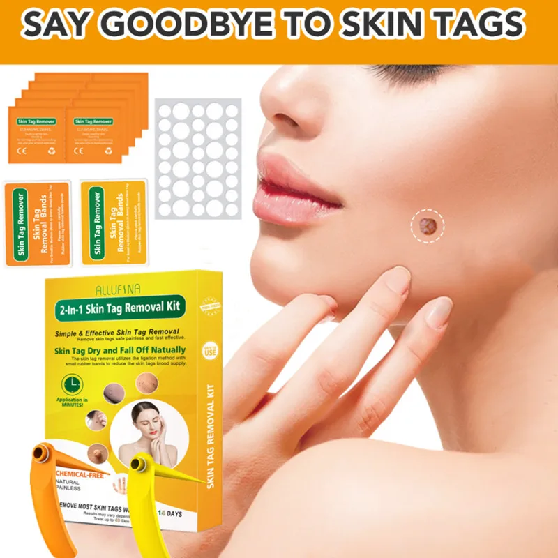 

Meat Moles Removal Kit Wart Removal Corneye Skin Label Removal Device Acne Patch Rubber Ring Facial Blemish Removal Skin Care