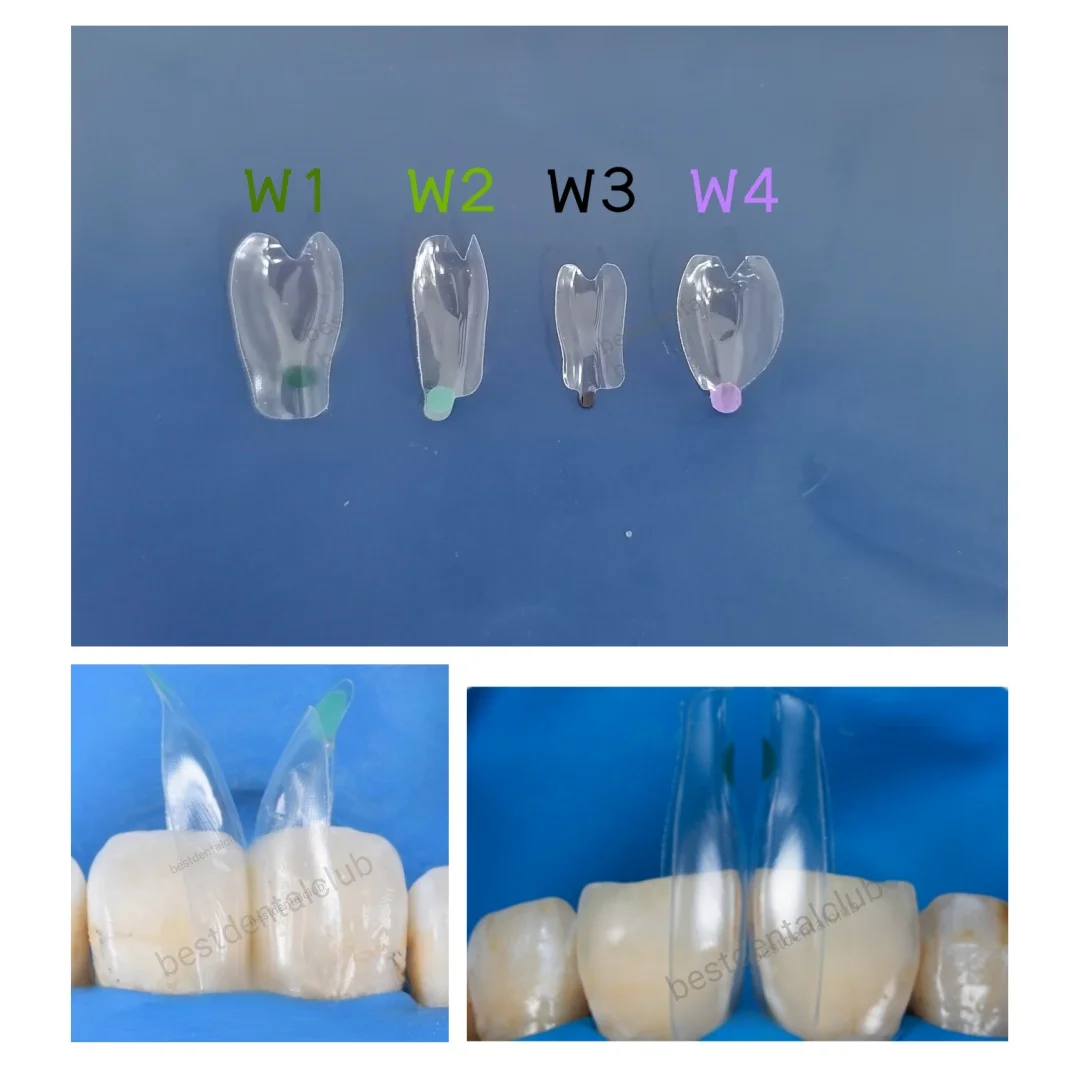 50 шт. стоматологическая прозрачная матричная внутренняя матрица