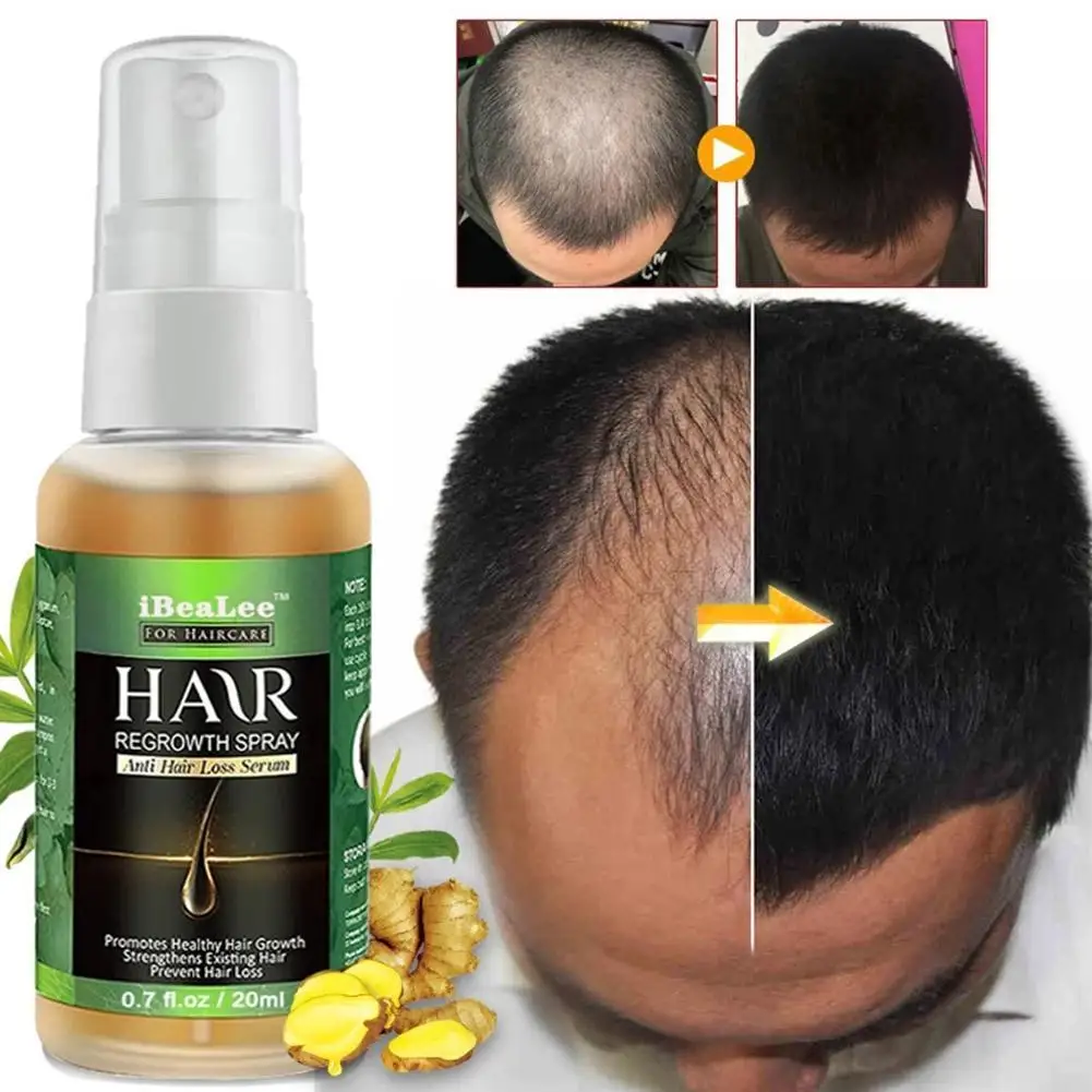 

Hair Growth Products Ginger Essential Oils Hair Care Essence Original Authentic 100% Hair Loss Liquid Health Care Beauty Dense