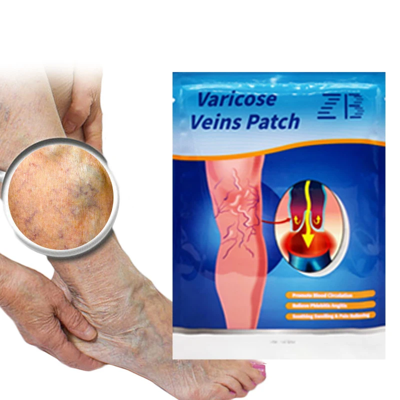 6/8/12 шт. лечение варикоцеле васкулита ног паука с венозным пластырем для снятия