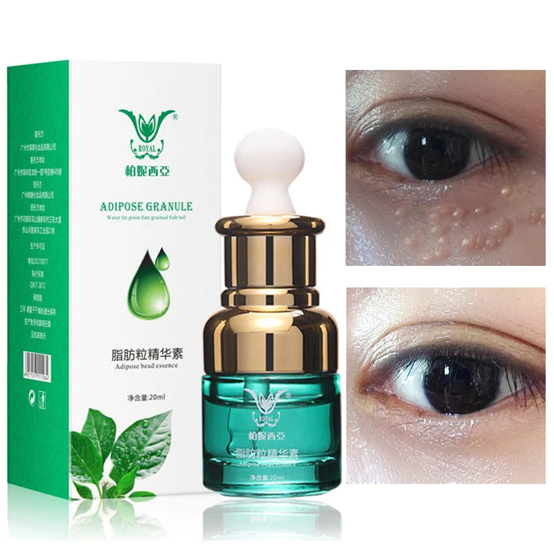 

Eye Serum Anti-Aging Wrinkle Soothing Remove Fat Particles Dark Circles Anti-Edema Firming Pulling Hyaluronic Acid Eye Care 20ml