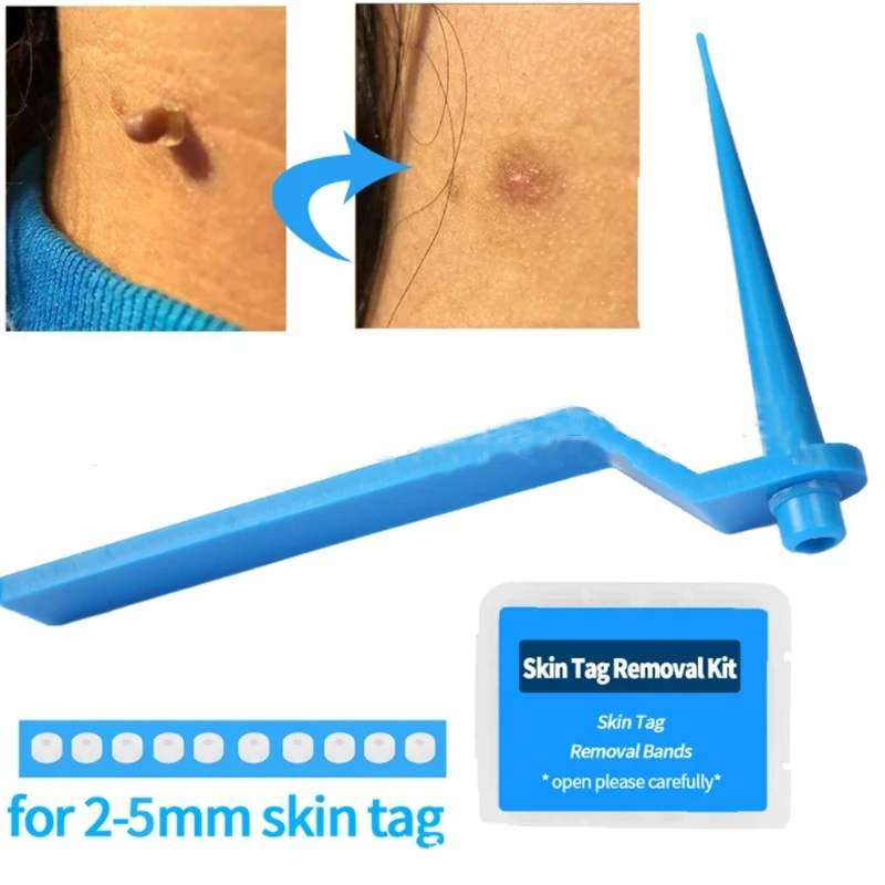 

Skin Tag Remover To Remover Wart Spot Remover Mole Remover Skin Care Warts Removal Medium Skin Tags Body Effect Band Beauty Tool
