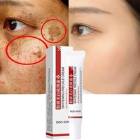 whitening freckle cream sunburn remover melasma acne dark spots anti aging niacinamide brighten moisturizing repair skin care