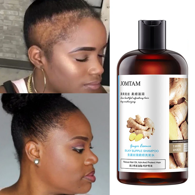 

Chebe Shampoo Hair Growth Serum Anti Preventing Hair Loss Alopecia Liquid Damaged Hair Repair Growing conditioner hair mask