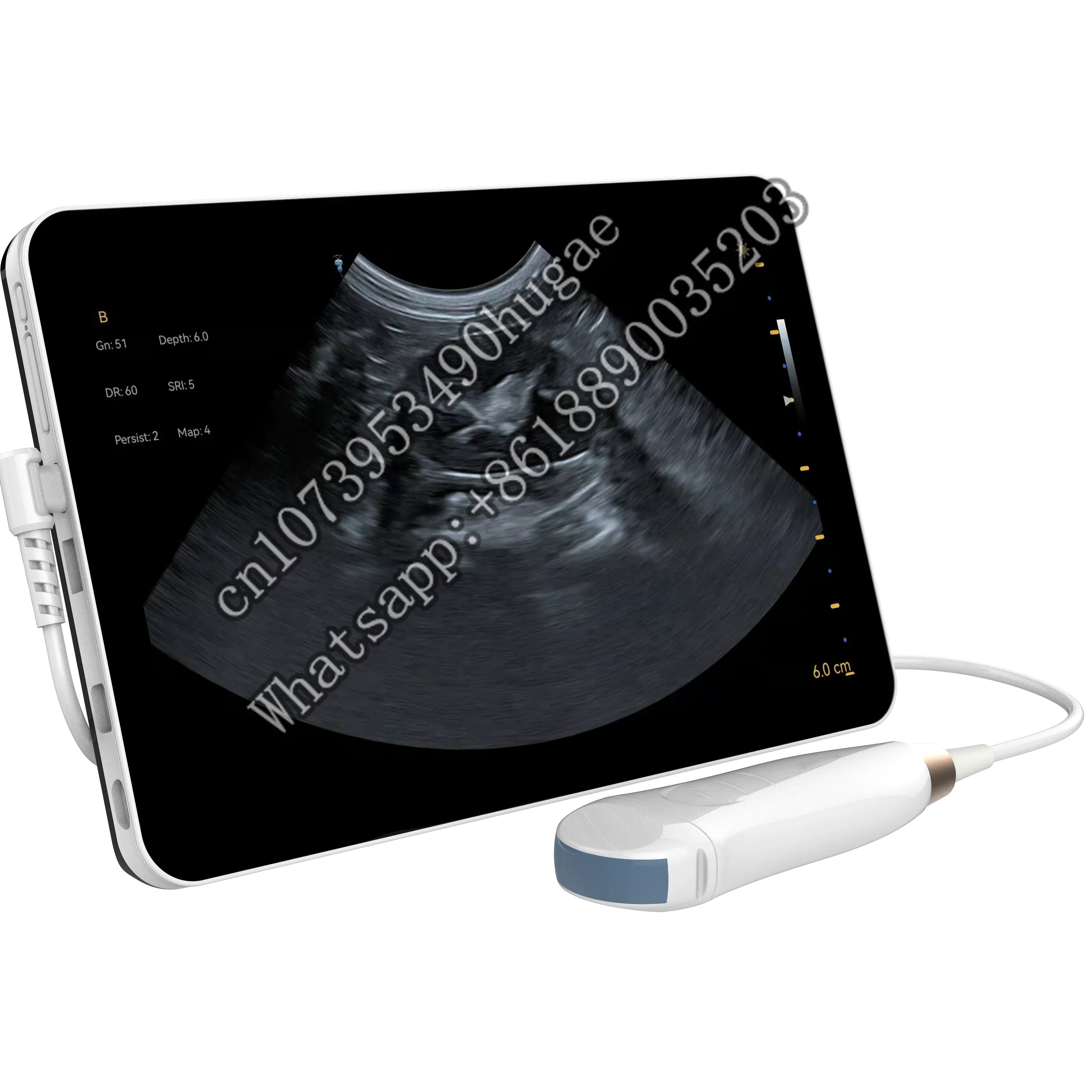 Компактное портативное ручное цифровое ультразвуковое диагностическое