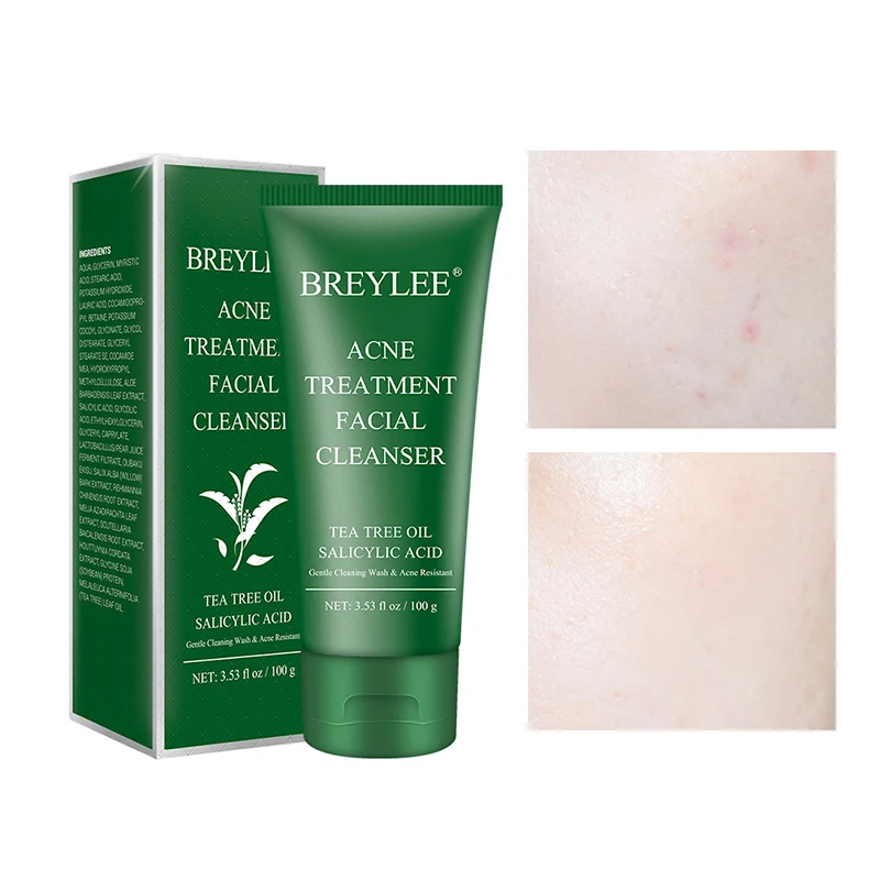 

Facial Cleanser Acne Treatment Face Cleansing Wash Mask Skin Care Cleaner Shrink Pore Oil Control Remove Blackhead Acnes 100g