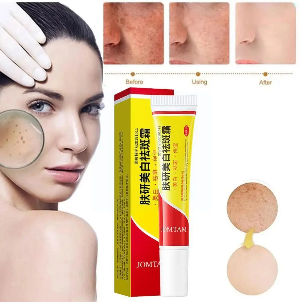 

Effective Whitening Freckle Cream Remove Melasma Acne Spots Pigmentation Whitening Dark Moisturizing Spot Melanin Pigment C W9K7