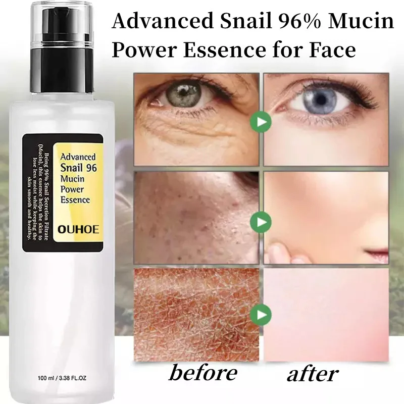 

Snail Mucin 96% Power Repairing Essence Lift Firm Anti-aging Fade Fine Lines Acne Treatment Facial Sensitive Whitening Brighten