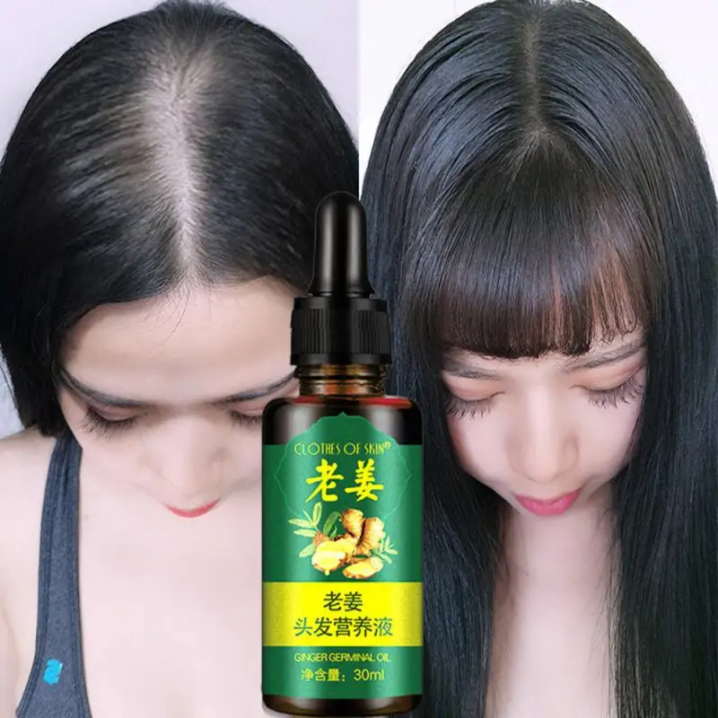 

Effective Ginger Hair Growth Ointment Hair Care Healthy Anti-Hair Loss Essence Oil Damaged Hair Nutrition Cream