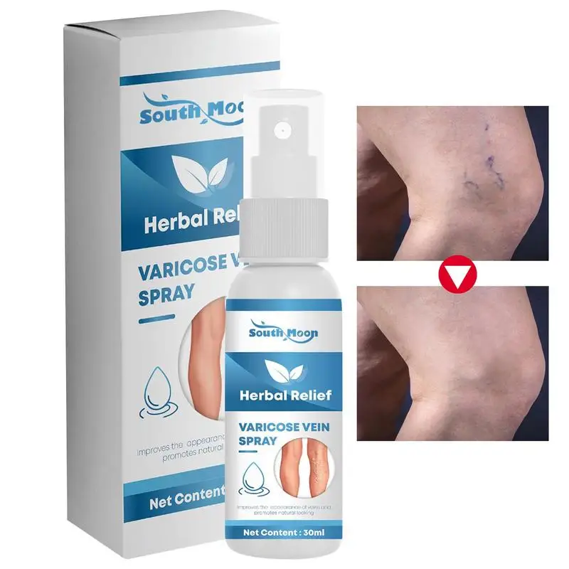 

Natural Vein Care Spray For Varicose Veins 30ml Effective Varicose Vein Relief Spray To Relieve Vasculitis Phlebitis Spider Legs