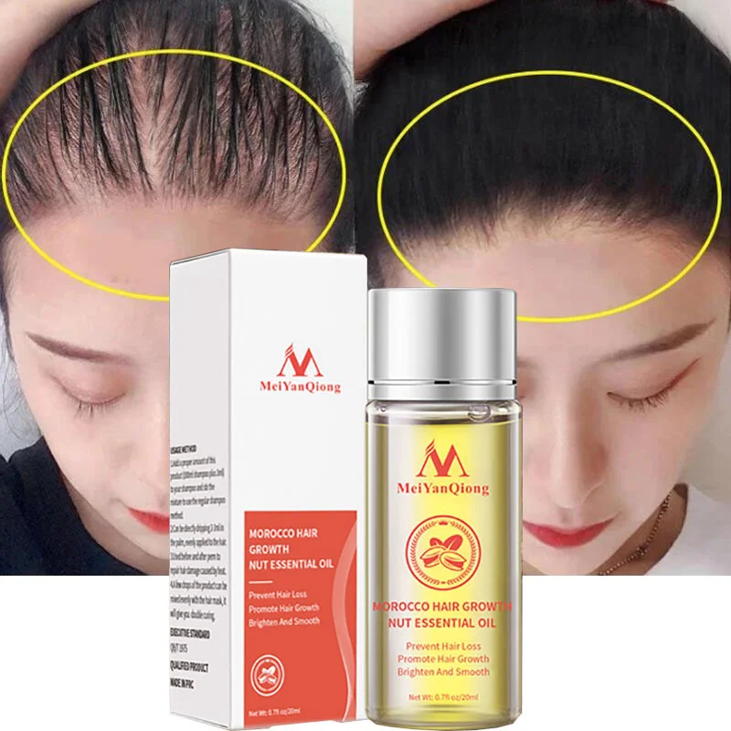 

Moroccan Hair Growth Essential Oil Fast Growing Hair Oil Nourishing Prevent Hair Loss Thinning Repair Damaged Hair Care Products