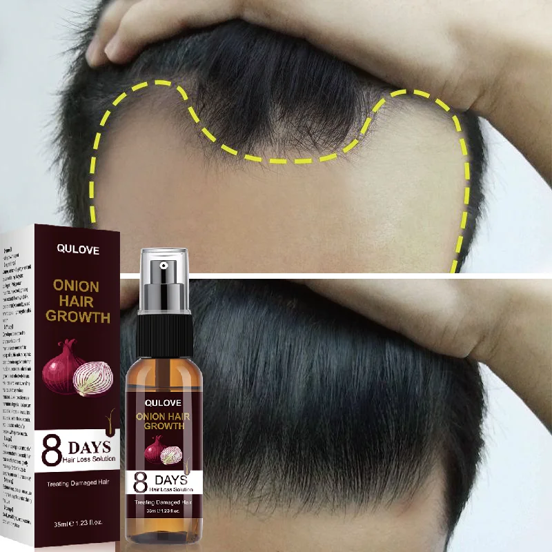 

Powerful Hair Growth Serum Onion Spray Anti Hair Loss Essence Treatment Products Repair Nourish Roots Scalp Regrowth Beauty Care