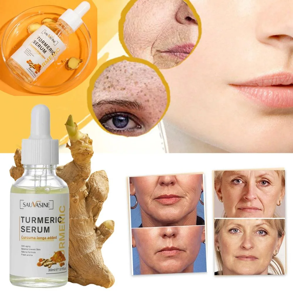 

30ML Turmeric Face Serum Whitening Dark Spot Remover Acne Scar Bright Skin Corrector Facial Essence Improve Roughness Skin Care